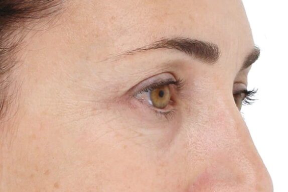 Close-up side view of a person's face, focusing on the eye area illuminated by soft lighting from LightStim. Eyebrow and part of the nose are visible. Skin appears natural with minor visible texture and fine lines. - OYESPA Aveda Lifestyle | nver Grove Heights, MN