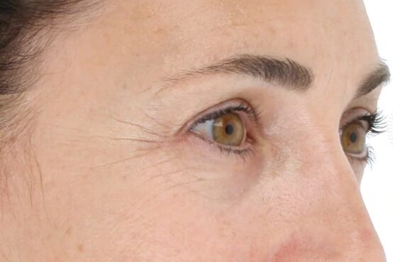 Close-up of a person's face focusing on the eye area with visible fine lines and wrinkles, showcasing light skin, brownish-green eyes, dark eyebrows, and the rejuvenating glow from a recent LightStim Spa treatment. - OYESPA Aveda Lifestyle | nver Grove Heights, MN